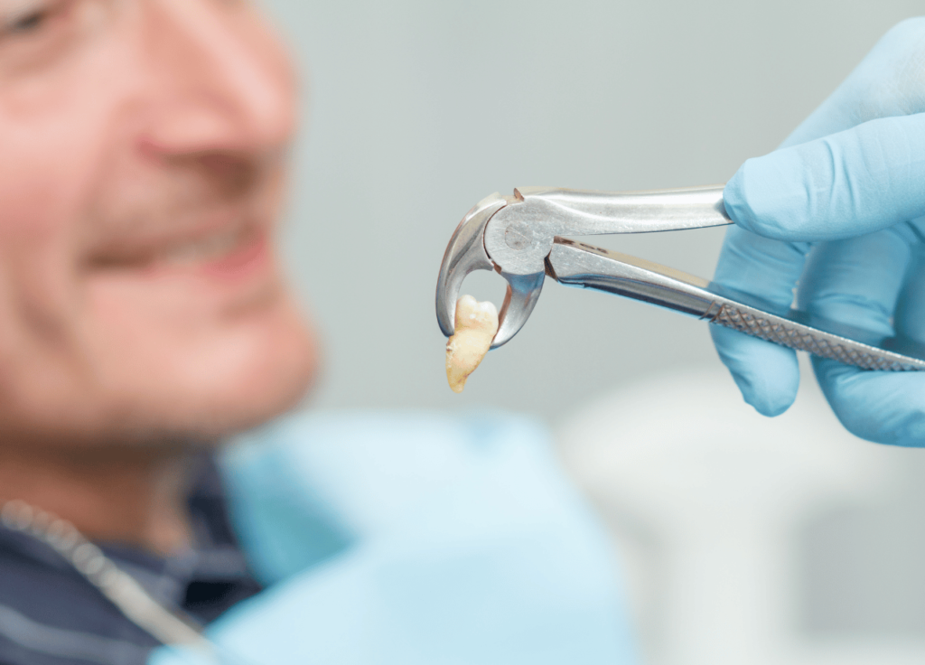 tooth extraction in West Roxbury
