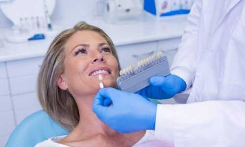 Doctor Holding Tooth Whitening Equipment By Patients