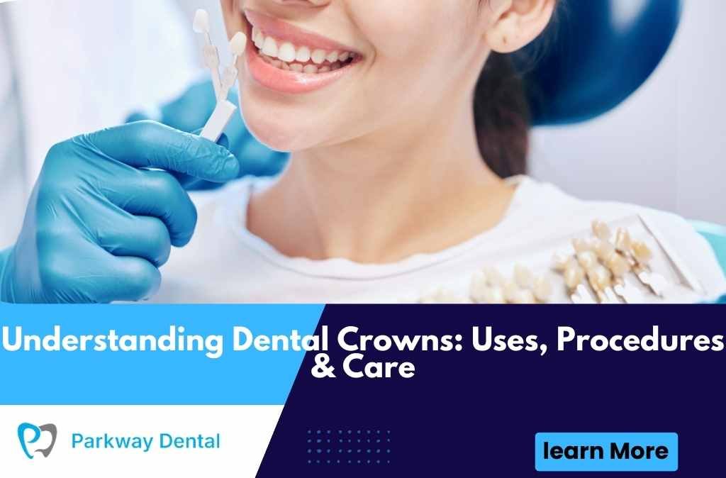 Understanding Dental Crowns: Uses, Procedures & Care