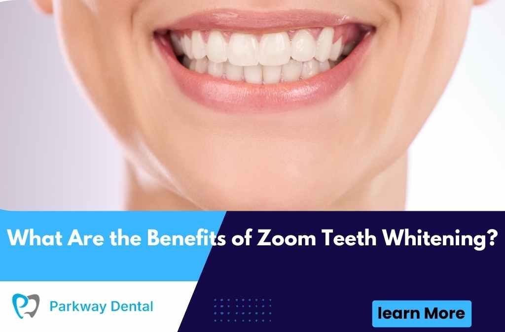 What Are the Benefits of Zoom Teeth Whitening?