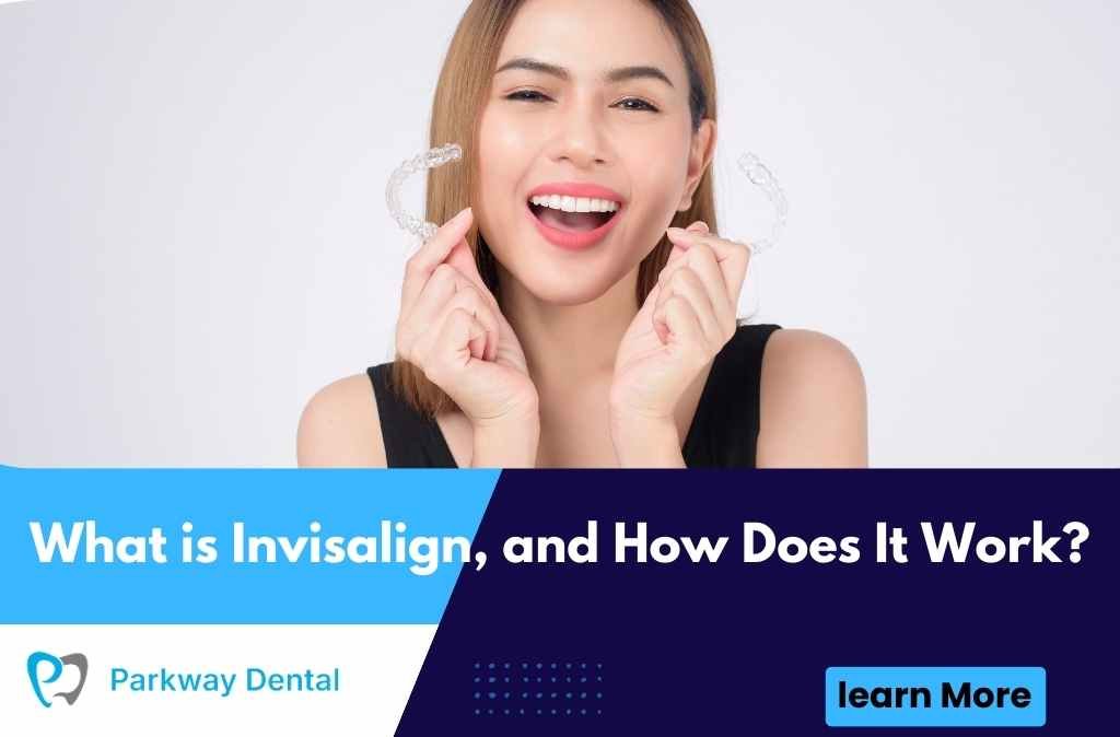 What is Invisalign, and How Does It Work?