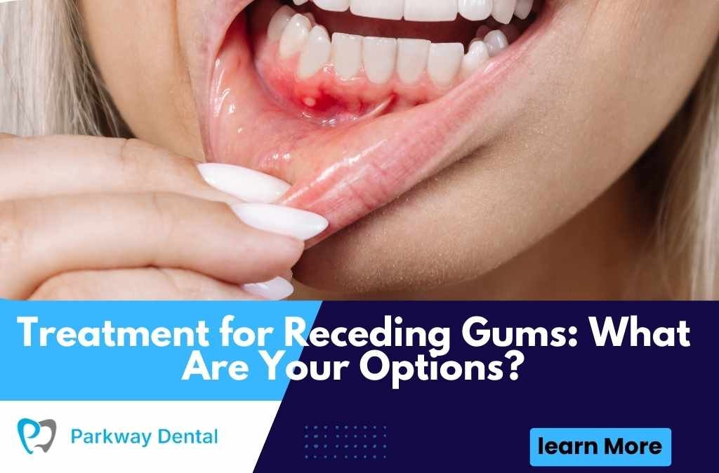 Treatment for Receding Gums: What Are Your Options?