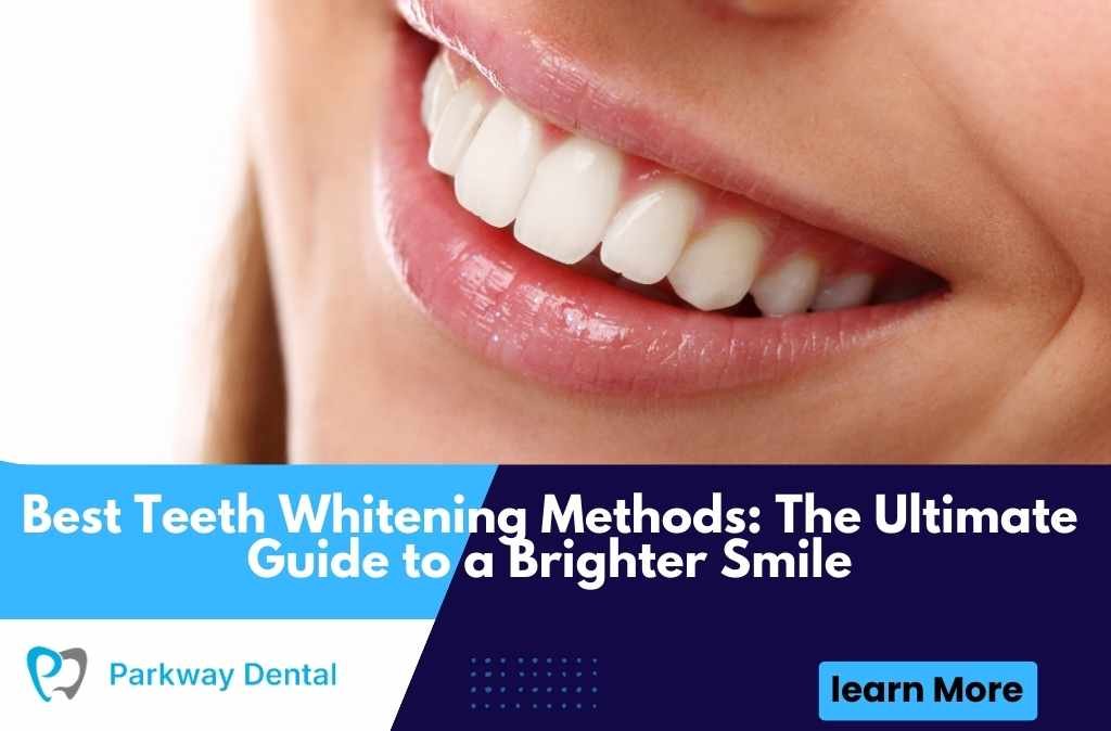 Best Teeth Whitening Methods
