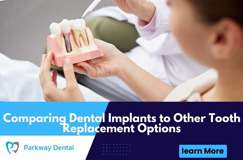 Comparing Dental Implants to Other Tooth Replacement Options