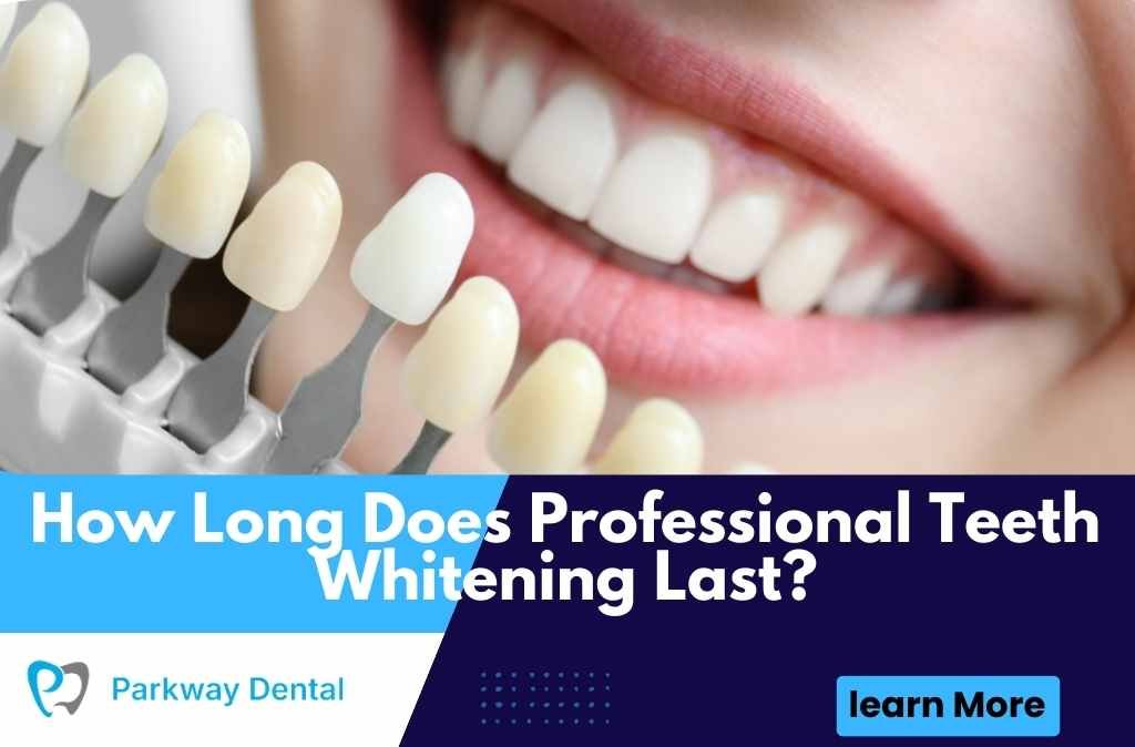 How Long Does Professional Teeth Whitening Last?