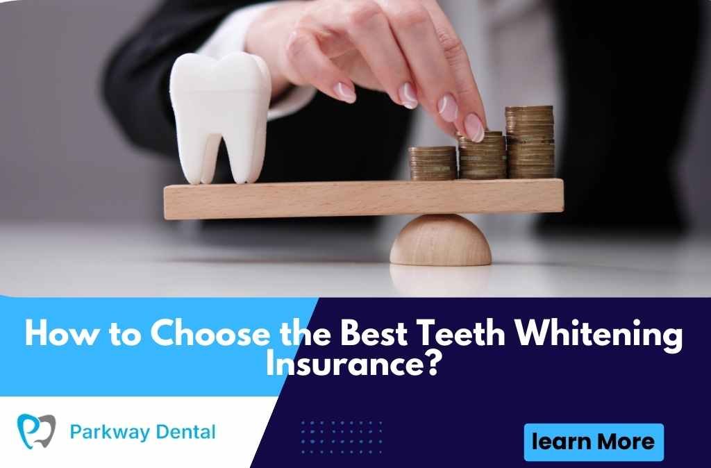 How to Choose the Best Teeth Whitening Insurance?