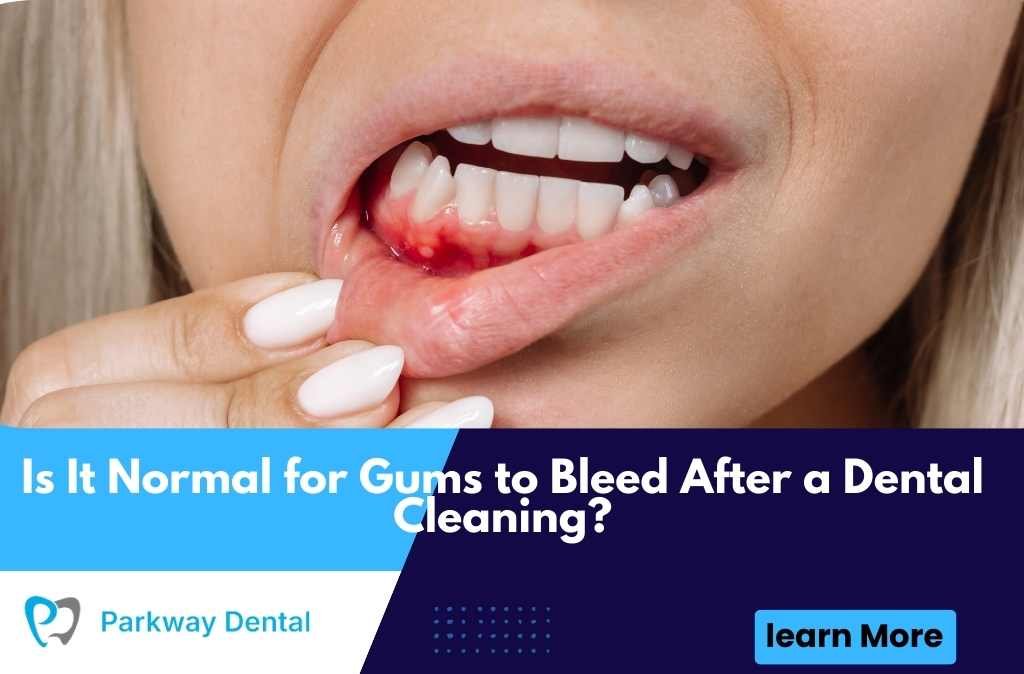 Is It Normal for Gums to Bleed After a Dental Cleaning?