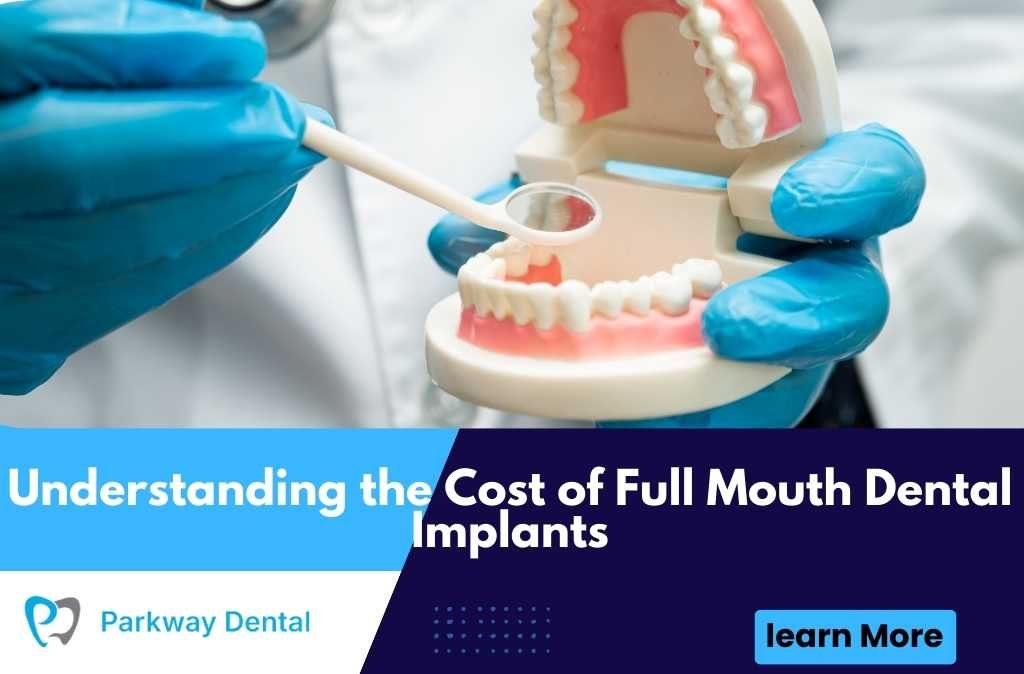 Understanding the Cost of Full Mouth Dental Implants