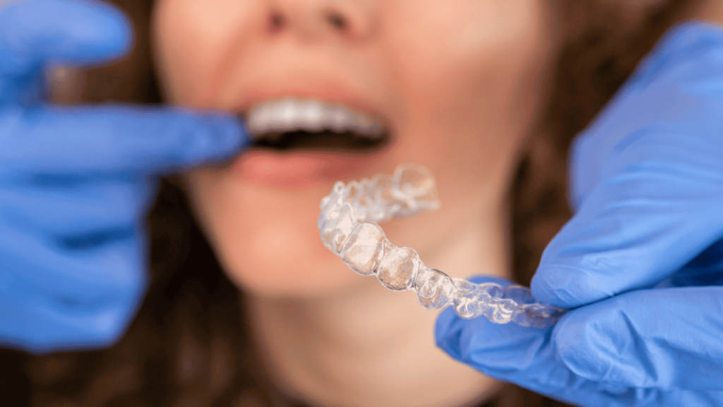 invisalign dental west roxbury