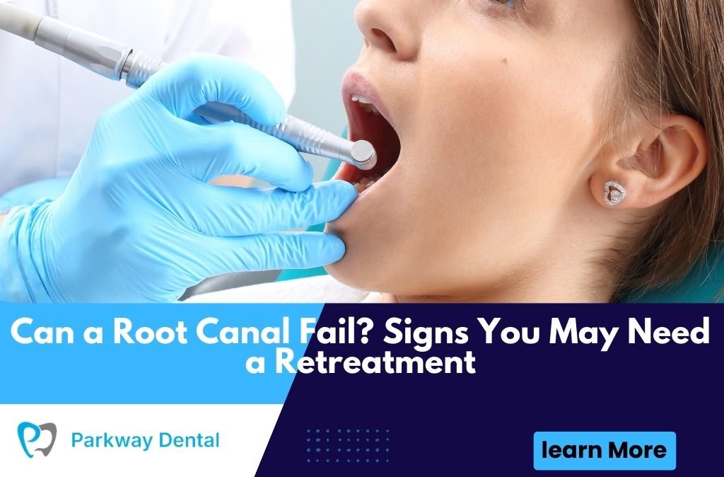 Can a Root Canal Fail? Signs You May Need a Retreatment