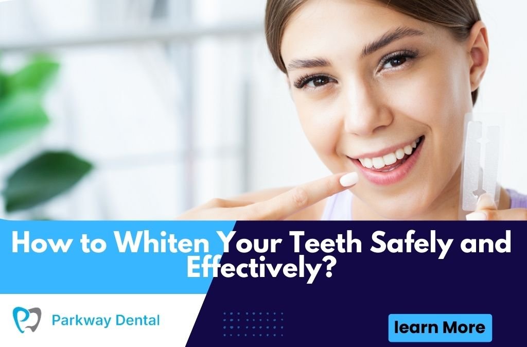 How to Whiten Your Teeth Safely and Effectively?