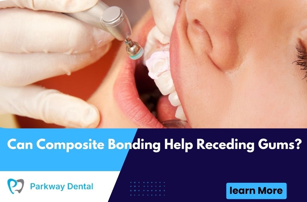 Can Composite Bonding Help Receding Gums?