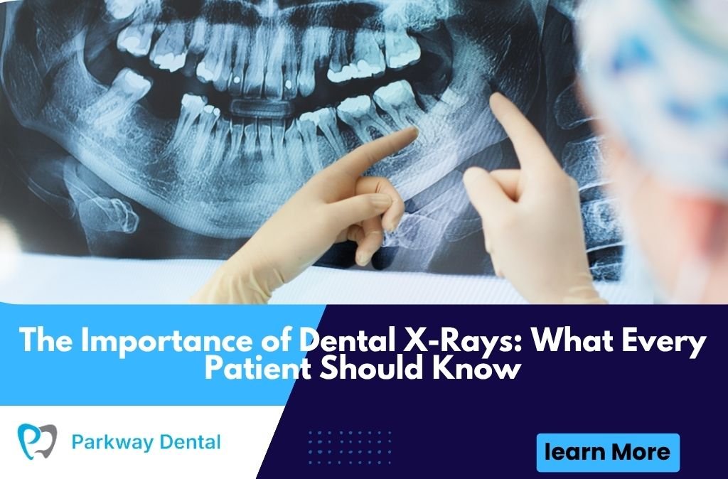 The Importance of Dental X-Rays: What Every Patient Should Know