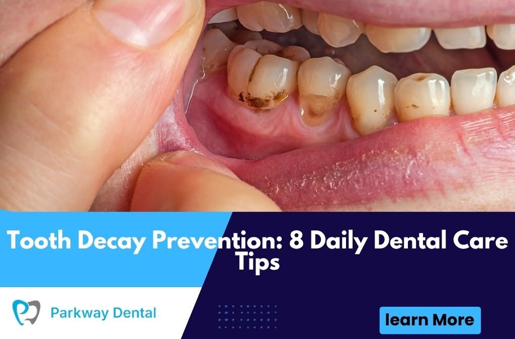 Tooth Decay Prevention: 8 Daily Dental Care Tips