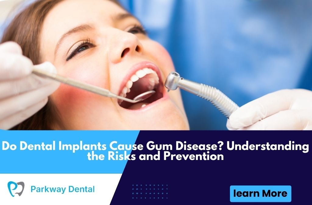 Do Dental Implants Cause Gum Disease?