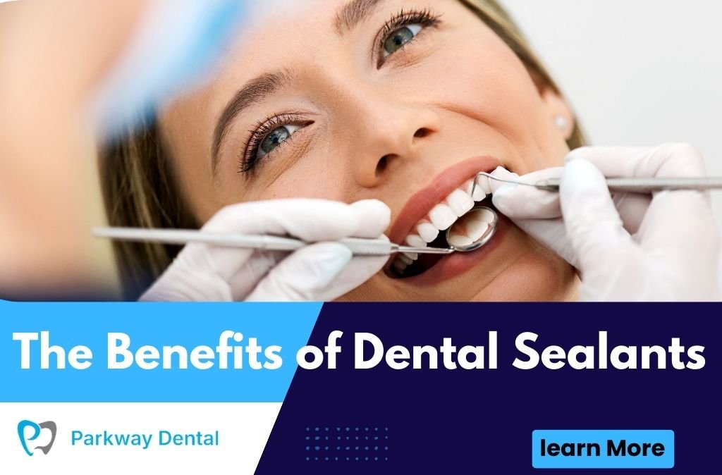The Benefits of Dental Sealants