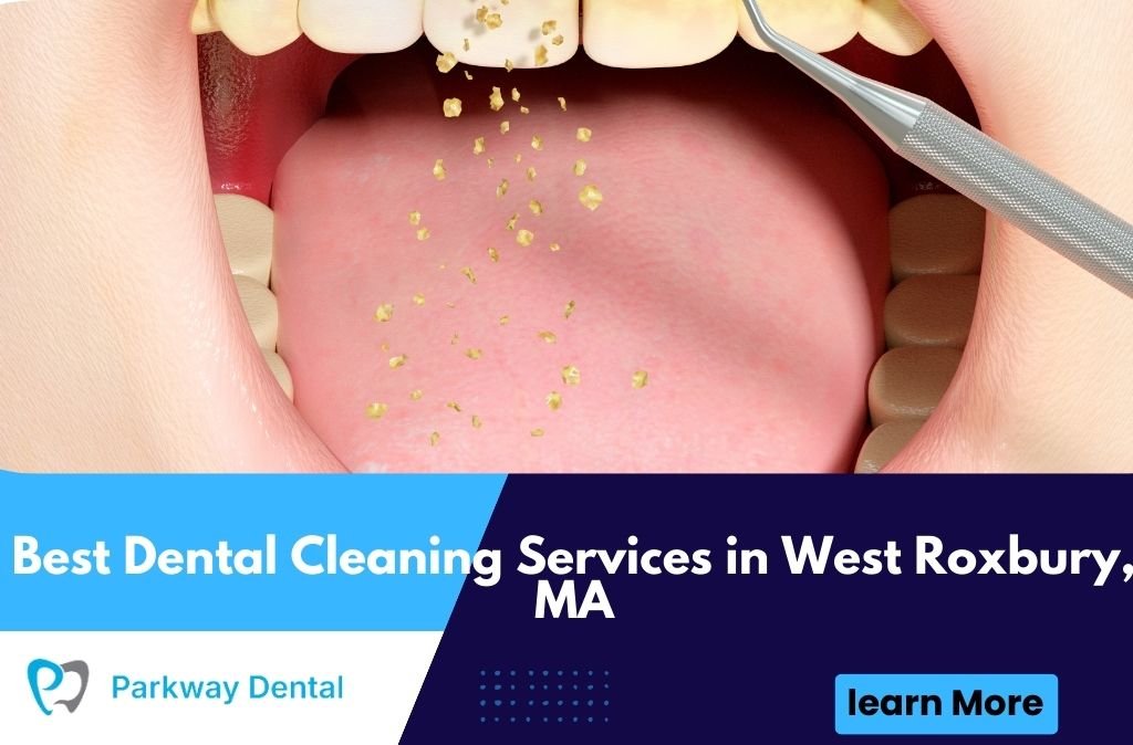 Best Dental Cleaning Services in West Roxbury, MA