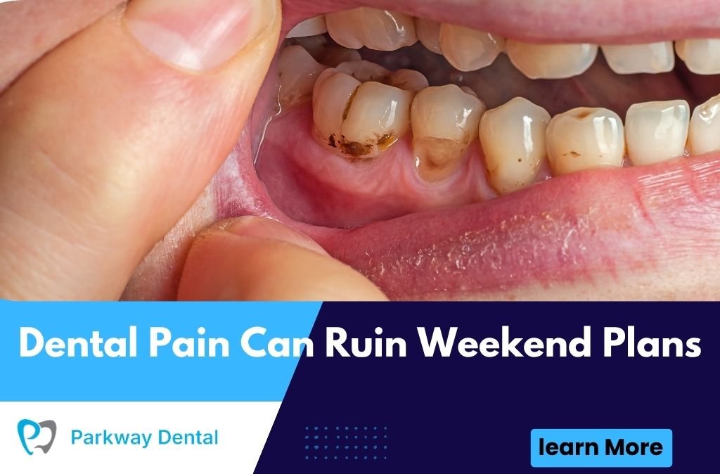 Dental Pain Can Ruin Weekend Plans