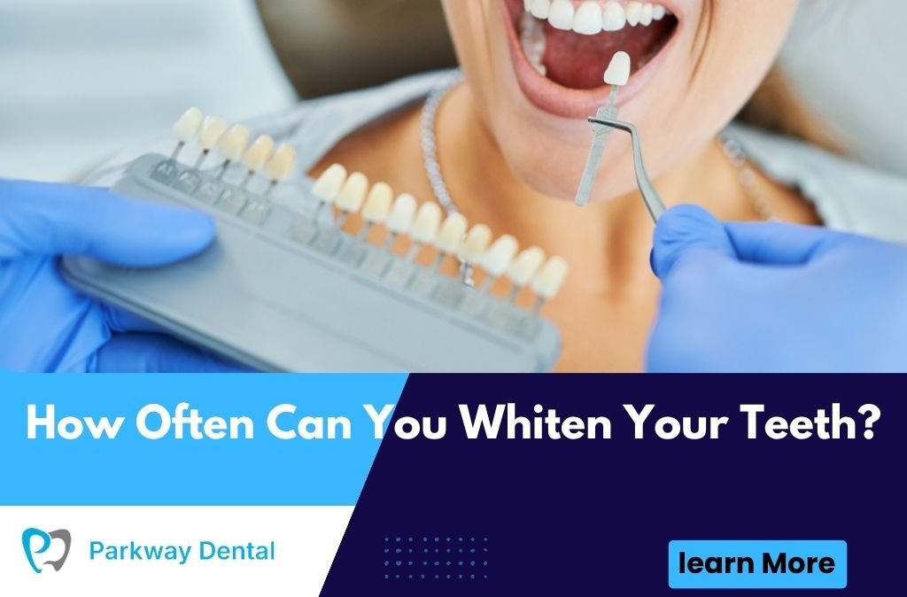How Often Can You Whiten Your Teeth?