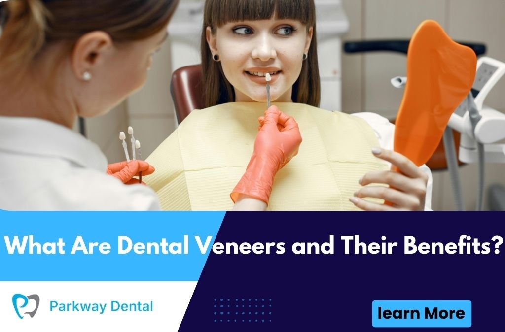 What Are Dental Veneers and Their Benefits?