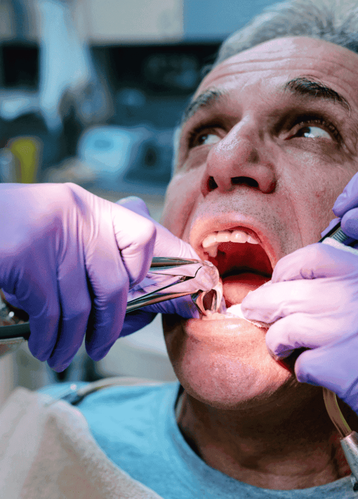 What to Expect During Tooth Extraction West Roxbury