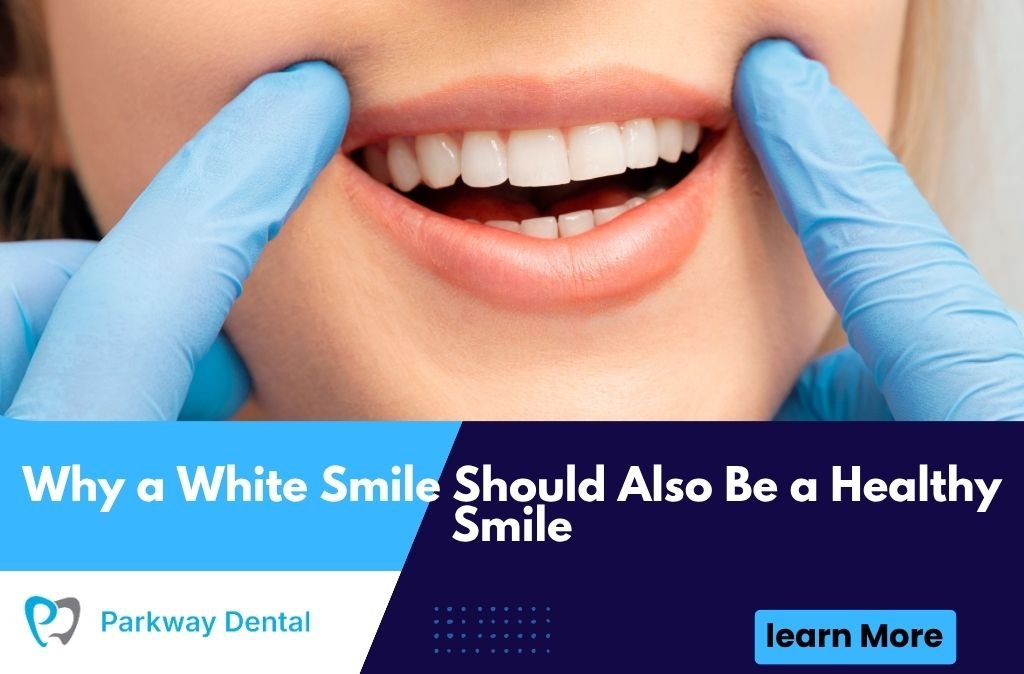 Why a White Smile Should Also Be a Healthy Smile