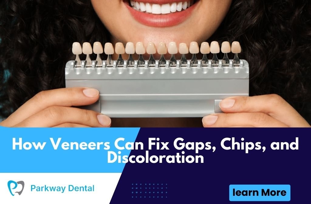 How Veneers Can Fix Gaps, Chips, and Discoloration