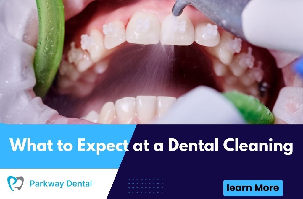 What to Expect at a Dental Cleaning