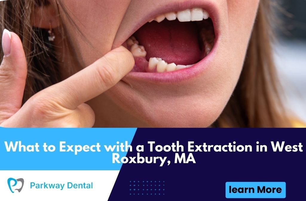 What to Expect with a Tooth Extraction in West Roxbury, MA