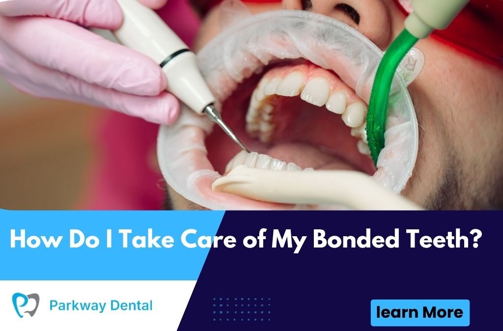 How Do I Take Care of My Bonded Teeth?
