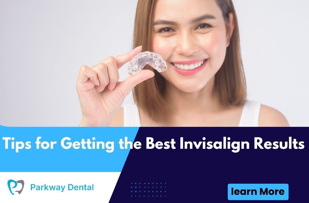 Tips for Getting the Best Invisalign Results