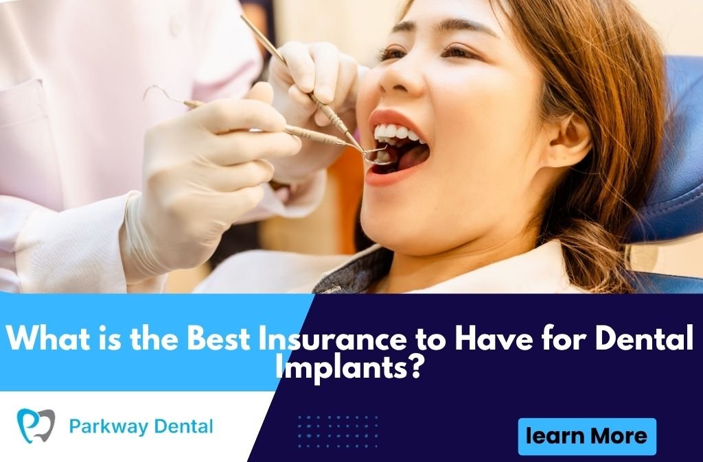 What is the Best Insurance to Have for Dental Implants?