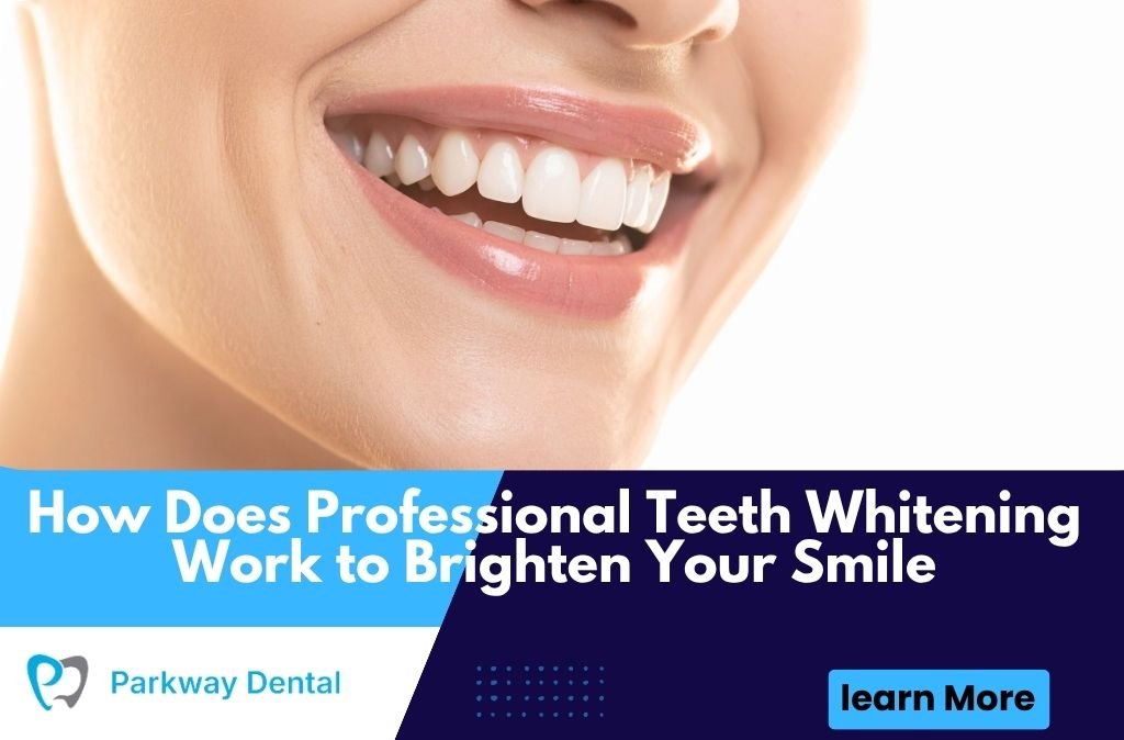 How Does Professional Teeth Whitening Work to Brighten Your Smile