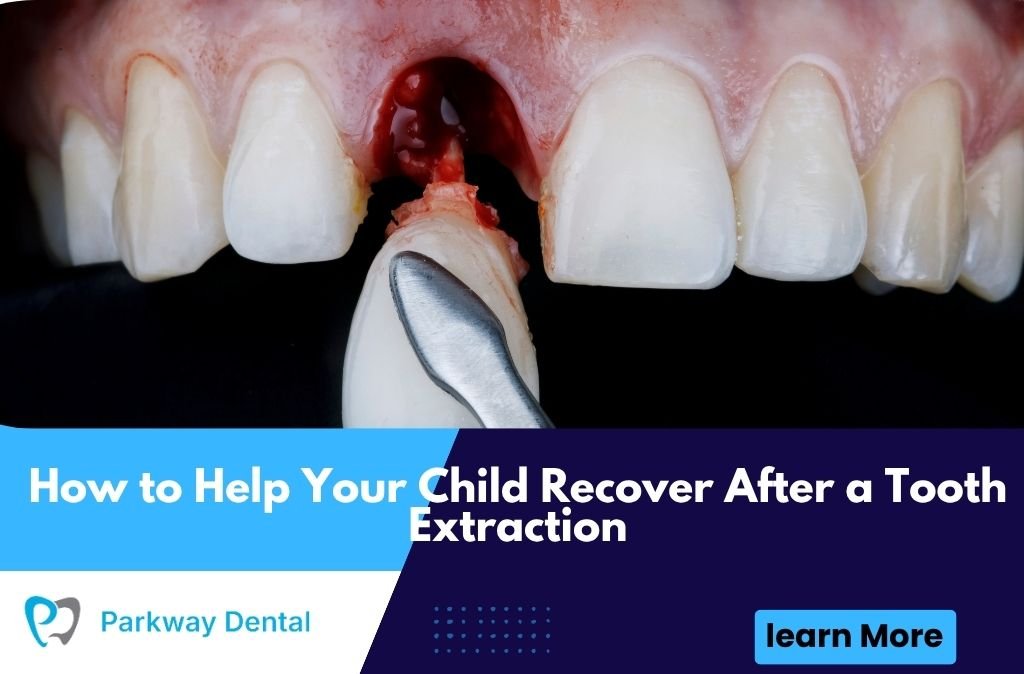 How to Help Your Child Recover After a Tooth Extraction