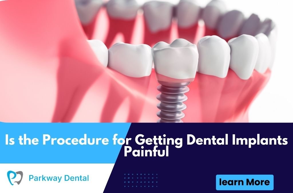 Is the Procedure for Getting Dental Implants Painful