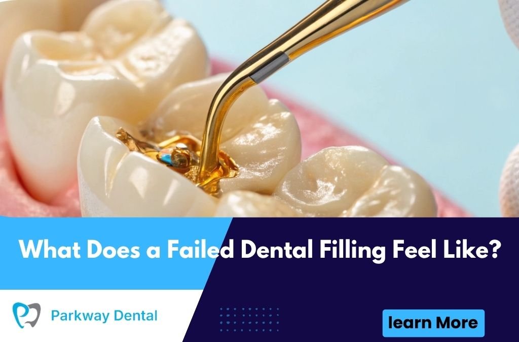 What Does a Failed Dental Filling Feel Like