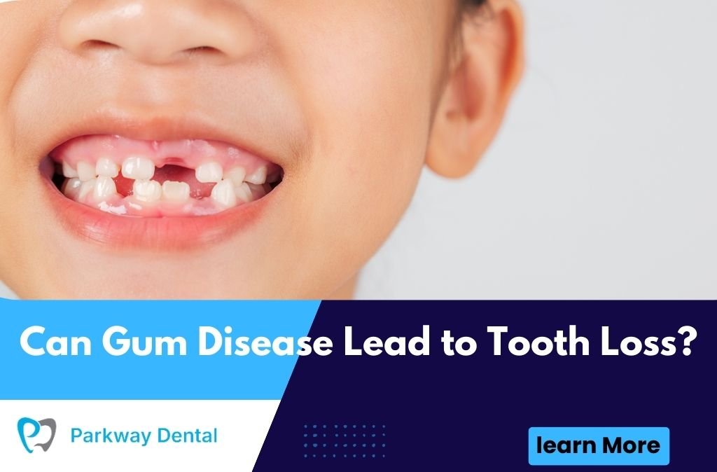 Can Gum Disease Lead to Tooth Loss