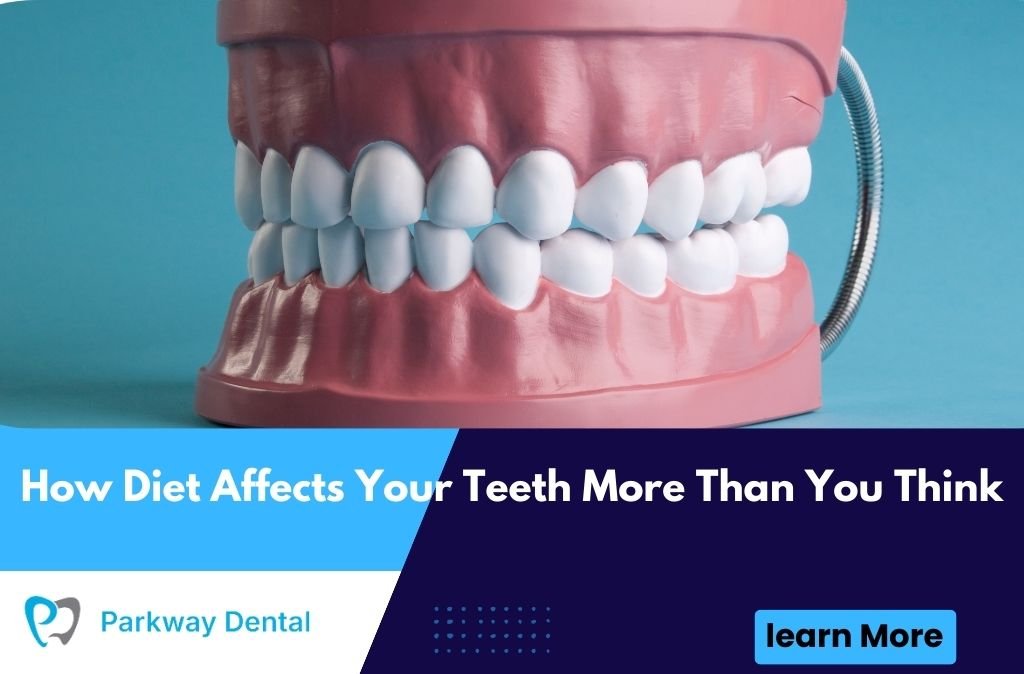 How Diet Affects Your Teeth More Than You Think