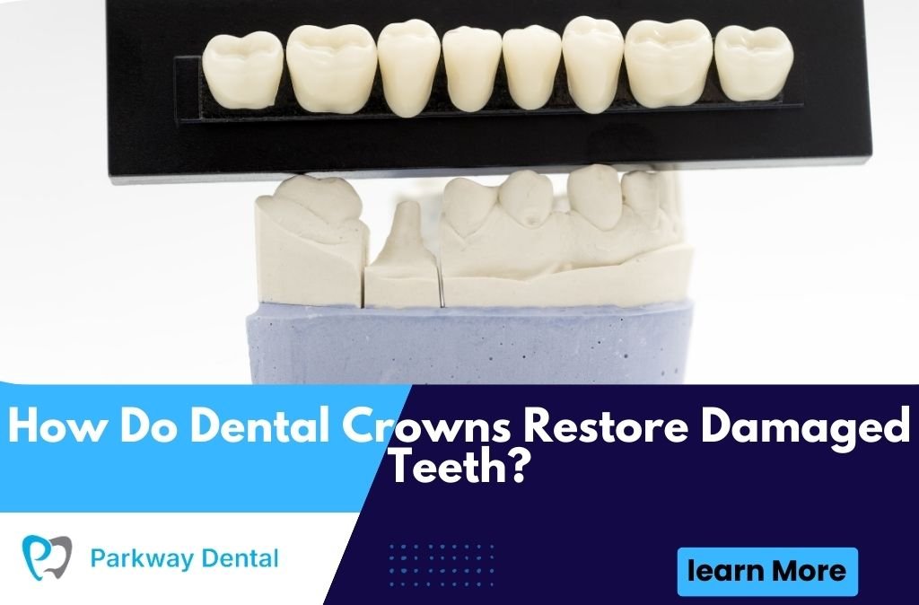 How Do Dental Crowns Restore Damaged Teeth