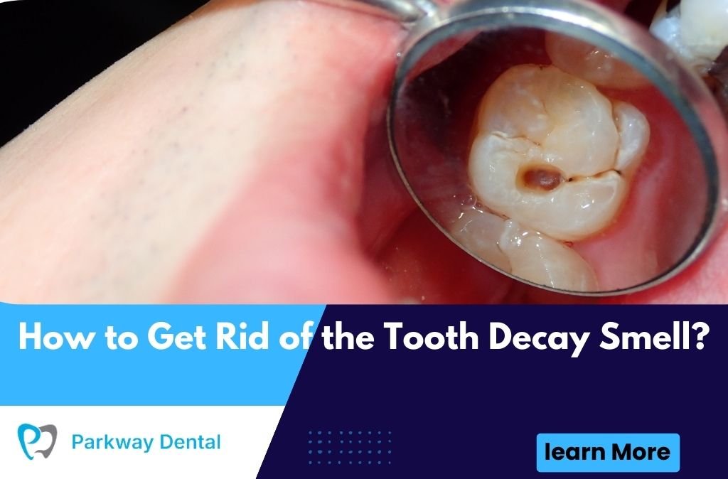 How to Get Rid of the Tooth Decay Smell