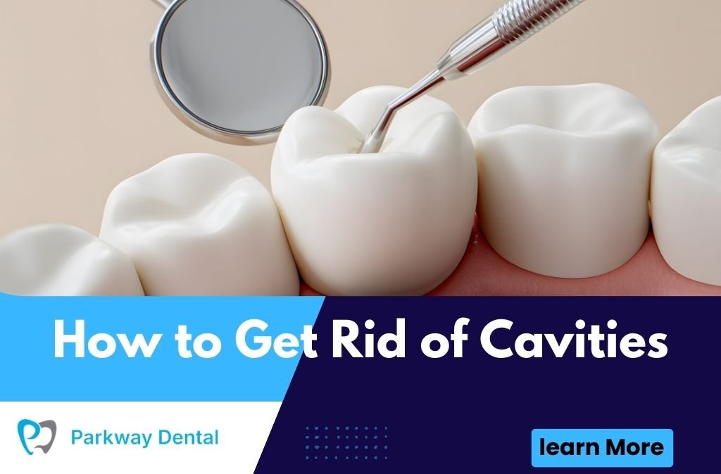 How to Get Rid of Cavities